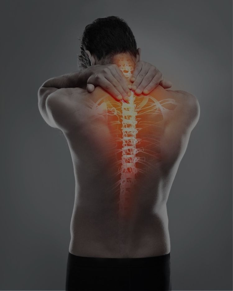 disability benefits after a back fusion