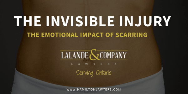 The Emotional Impact of Trauma Related Scarring