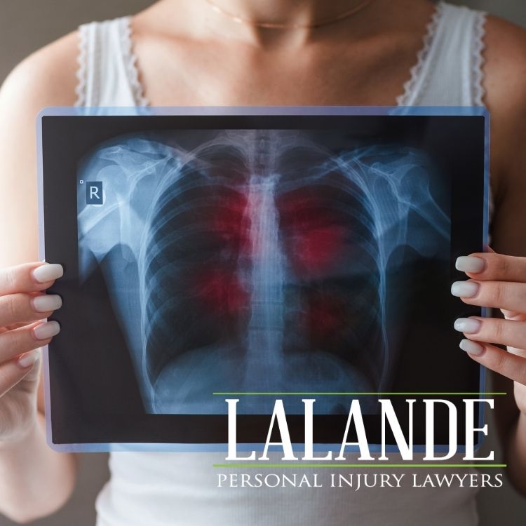 Lung Cancer and Long-Term Disability Benefits