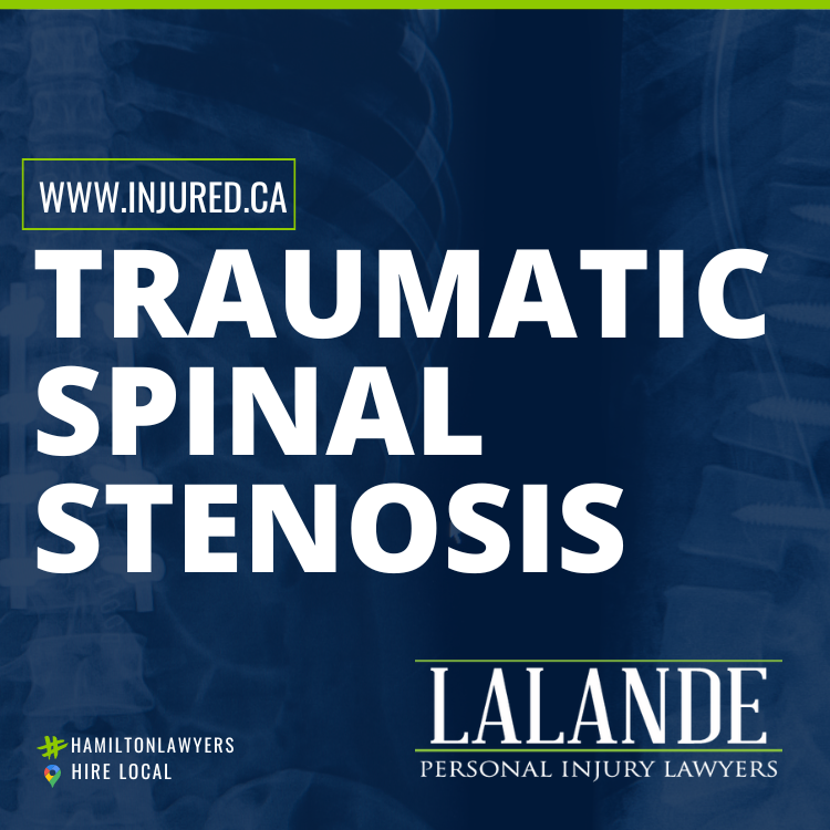 Traumatic Spinal Stenosis