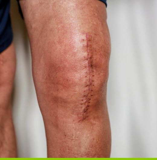 lawyer for compensation for traumatic scarring cta1