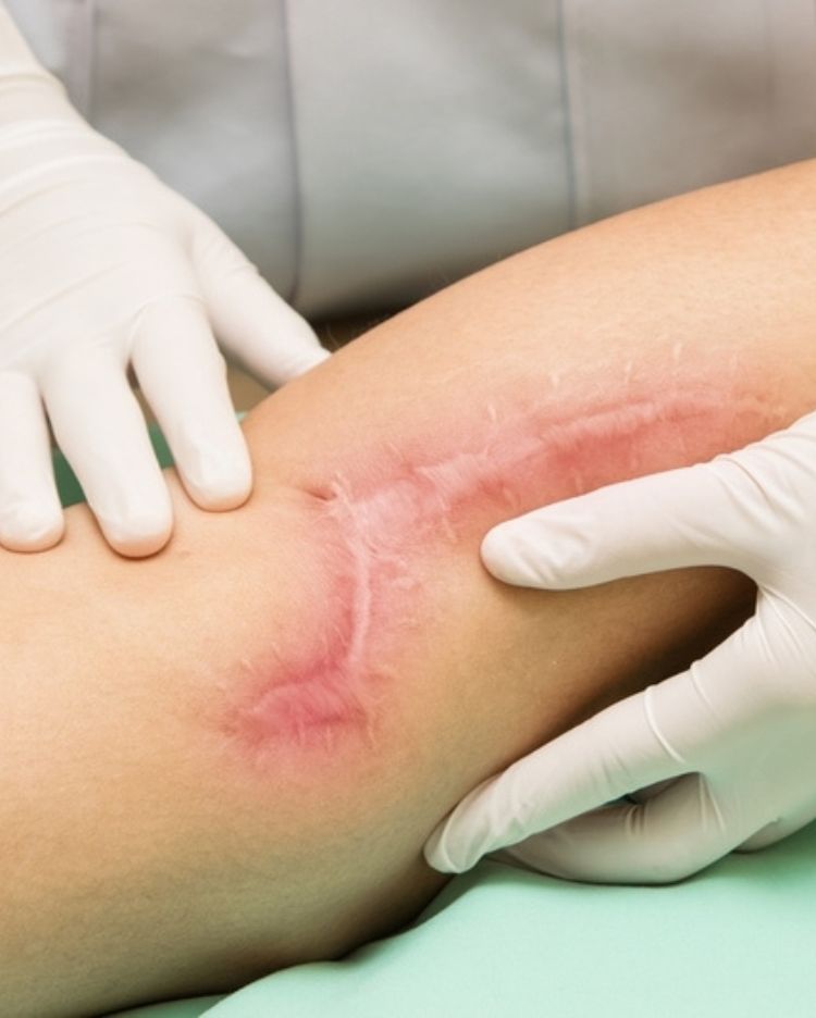 The  Emotional & Psychological Impact of Traumatic Scarring